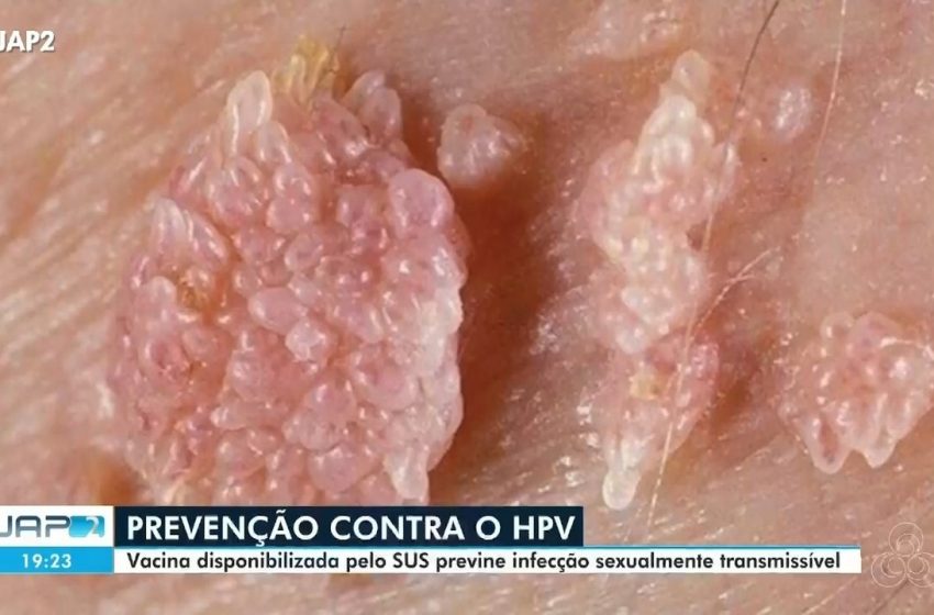  ‘Carreta Delas’: ação oferta exames e consultas gratuitas na Zona Sul de Macapá