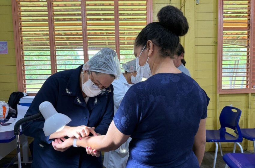  Seis casos de tuberculose latente são confirmados em comunidade rural de Macapá