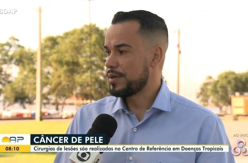  CRDT no Amapá oferece cirurgias para remoção de câncer de pele; veja como agendar