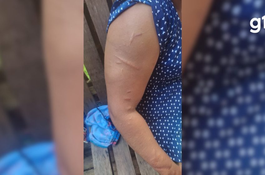  'Me sentindo como um passarinho livre', diz mulher resgatada após ser mantida em cárcere privado por 15 anos no AP